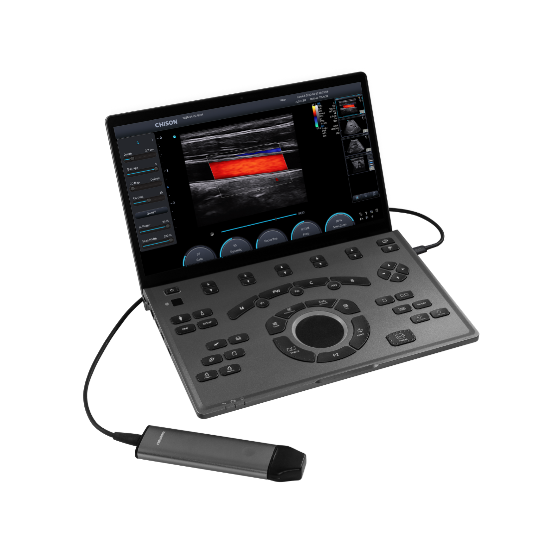 Chison SonoAir 30 mit 1 Sonde