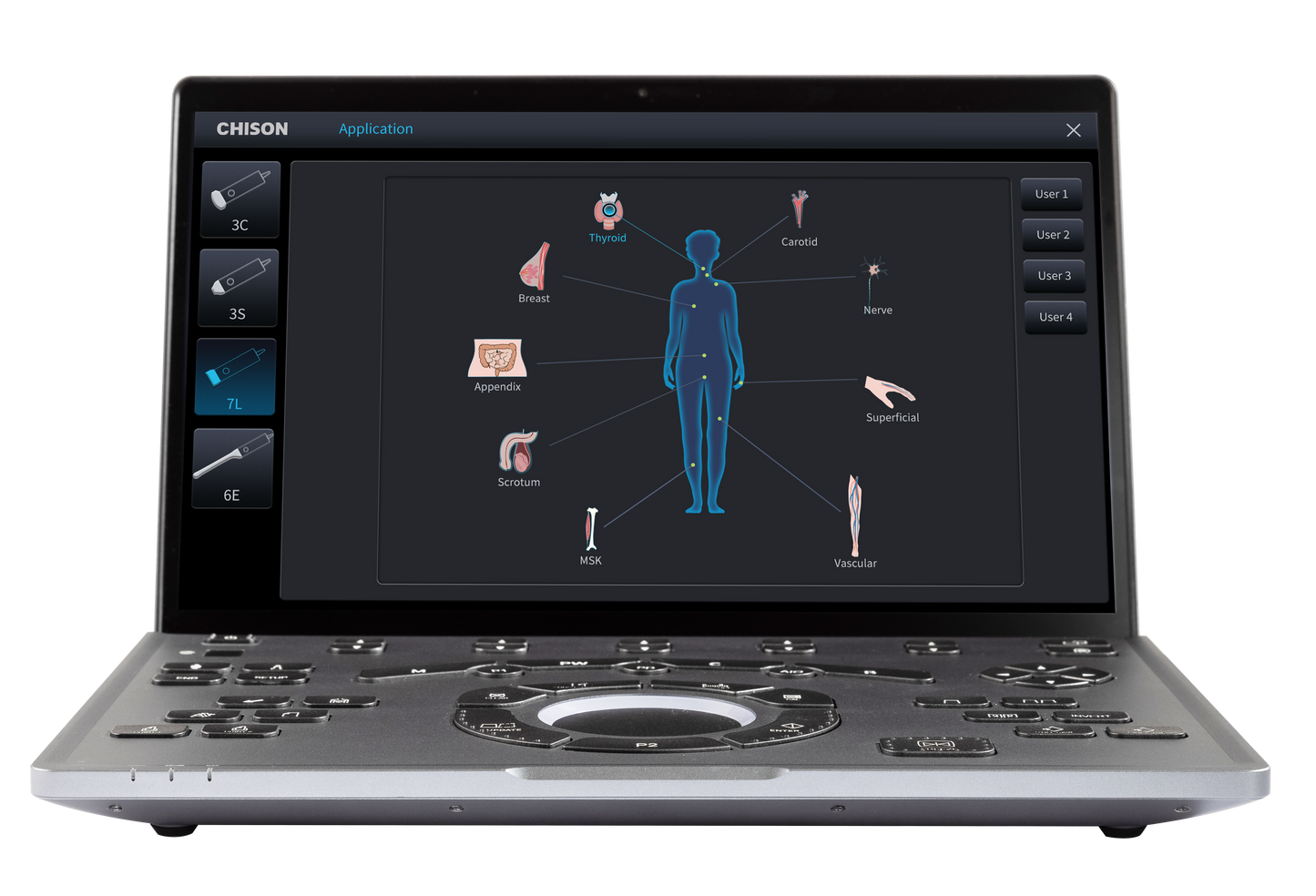 Chison SonoAir 30 Austeller mit Linear- & Convexsonde (inkl. 2 Sonden)